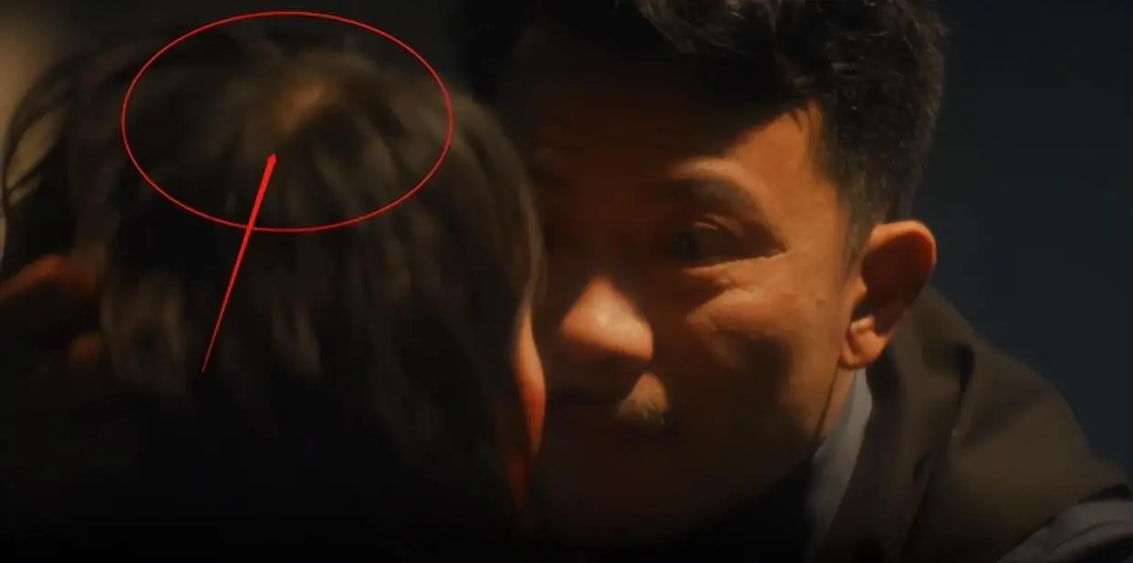 女明星脱发严重_杨幂赵丽颖金晨假发片_发量少的女明星有哪些